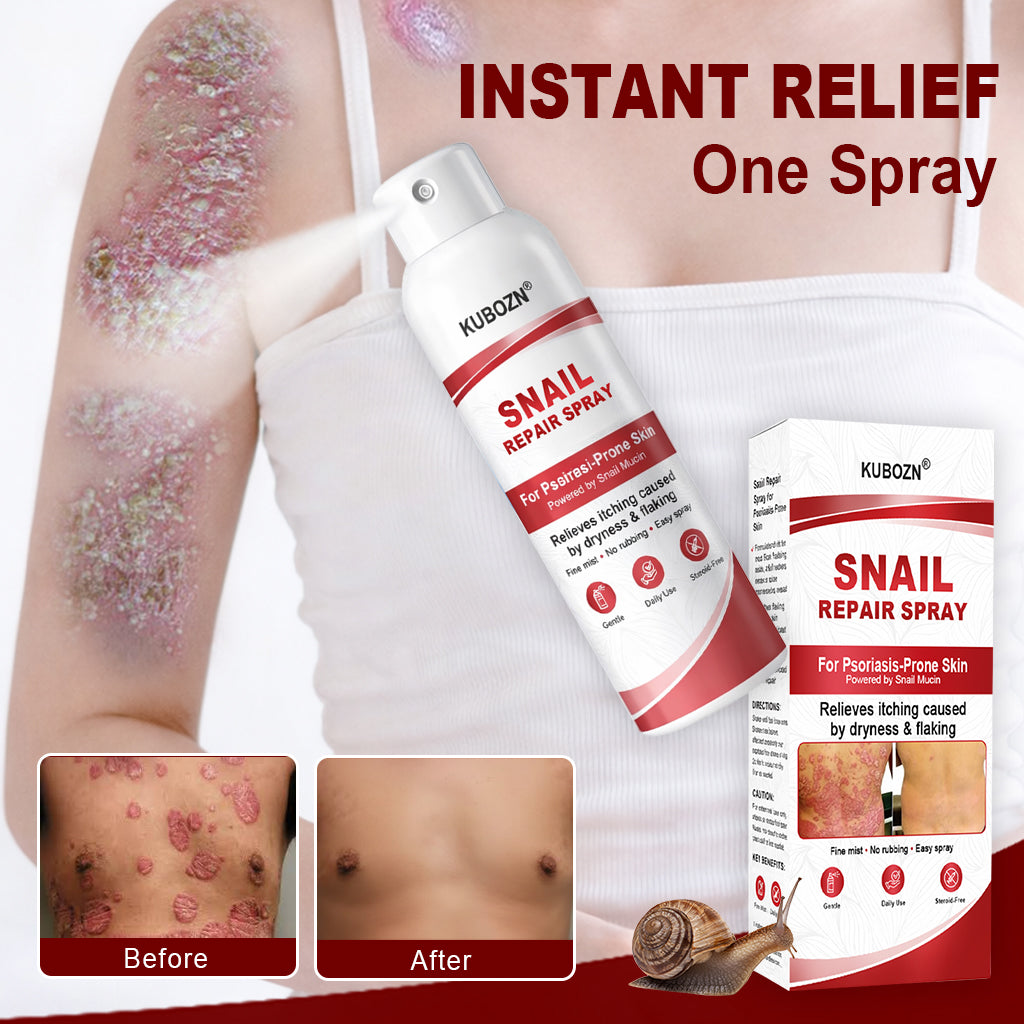 KUBOZN® Snail Repair Spray for Itchy, Flaky Psoriasis Skin 1