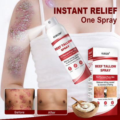 KUBOZN® Beef Tallow Spray for Itchy, Flaky Psoriasis Skin 1 (offer)