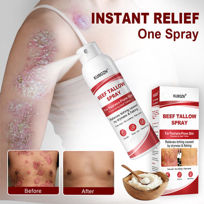 KUBOZN® Beef Tallow Spray for Itchy, Flaky Psoriasis Skin 1