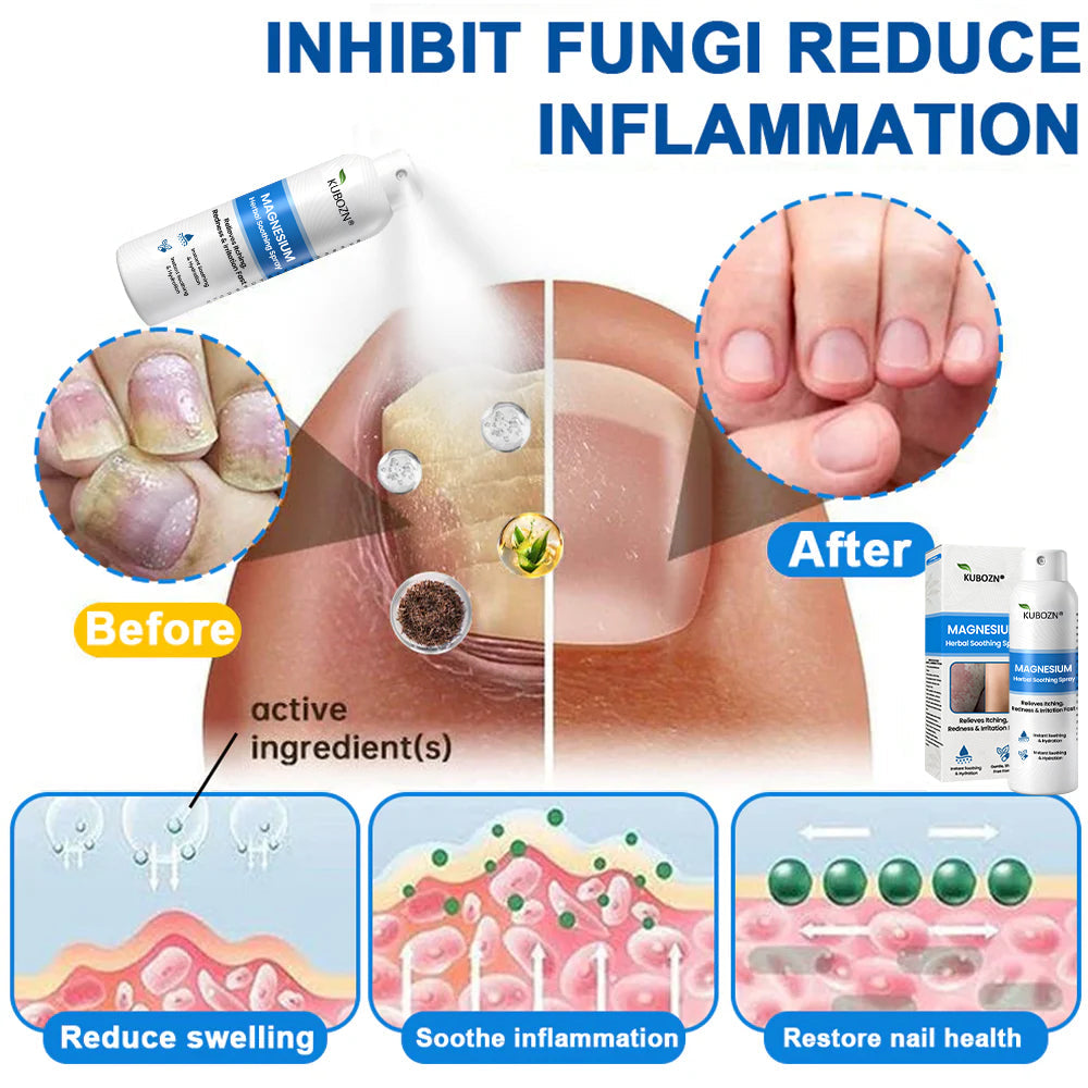 ✅  Official Store: KUBOZN® Magnesium Herbal Psoriasis Spray ⚕️ FDA Certified