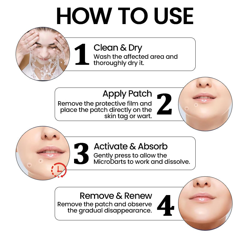 KUBOZN® Pro MicroDarts TAG'Gone Patch ✨