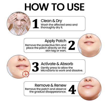 KUBOZN® Pro MicroDarts TAG'Gone Patch ✨